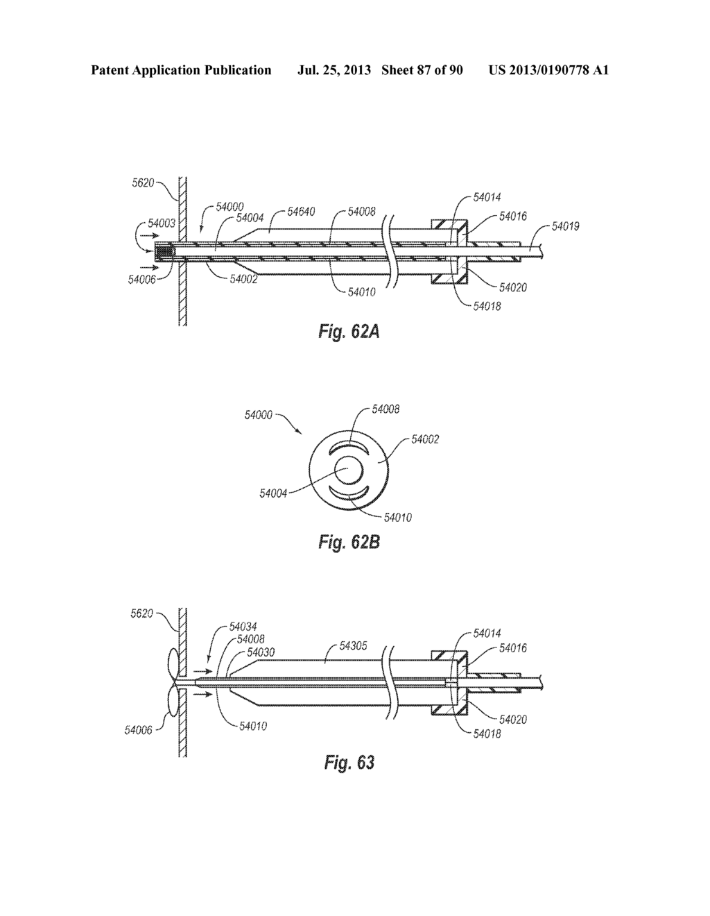 CLIP APPLIER AND METHODS OF USE - diagram, schematic, and image 88