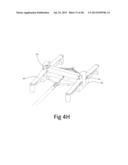 Lock Bar Spring And Clip For Implant Deployment Device diagram and image