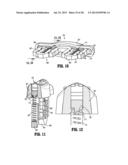 Lock Bar Spring And Clip For Implant Deployment Device diagram and image