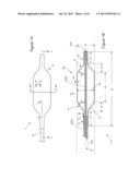  INFLATABLE MEDICAL DEVICES  diagram and image