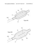  INFLATABLE MEDICAL DEVICES  diagram and image