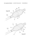  INFLATABLE MEDICAL DEVICES  diagram and image