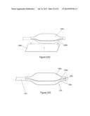  INFLATABLE MEDICAL DEVICES  diagram and image