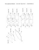  INFLATABLE MEDICAL DEVICES  diagram and image