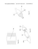  INFLATABLE MEDICAL DEVICES  diagram and image