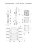  INFLATABLE MEDICAL DEVICES  diagram and image