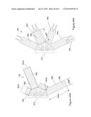  INFLATABLE MEDICAL DEVICES  diagram and image