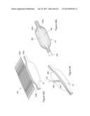  INFLATABLE MEDICAL DEVICES  diagram and image