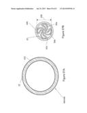  INFLATABLE MEDICAL DEVICES  diagram and image