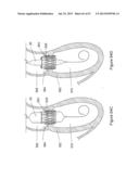  INFLATABLE MEDICAL DEVICES  diagram and image