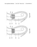  INFLATABLE MEDICAL DEVICES  diagram and image