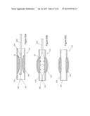  INFLATABLE MEDICAL DEVICES  diagram and image