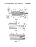 DETACHABLE ANEURYSM NECK BRIDGE diagram and image