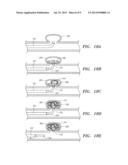 DETACHABLE ANEURYSM NECK BRIDGE diagram and image