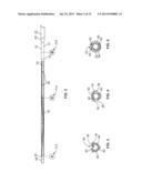 IVC FILTER CATHETER WITH IMAGING MODALITY diagram and image