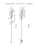 IVC FILTER CATHETER WITH IMAGING MODALITY diagram and image