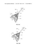 IVC FILTER CATHETER WITH IMAGING MODALITY diagram and image