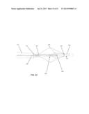 IVC FILTER CATHETER WITH IMAGING MODALITY diagram and image