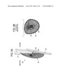 SINGLE DISC OCCLUSIONARY PATENT FORAMEN OVALE CLOSURE DEVICE diagram and image