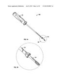 COMPRESSION SCREW SYSTEM diagram and image