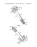 COMPRESSION SCREW SYSTEM diagram and image