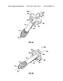 COMPRESSION SCREW SYSTEM diagram and image