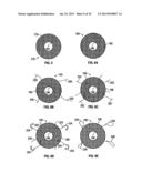 COMPRESSION SCREW SYSTEM diagram and image