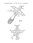 COMPRESSION SCREW SYSTEM diagram and image