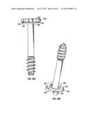 COMPRESSION SCREW SYSTEM diagram and image