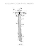 COMPRESSION SCREW SYSTEM diagram and image