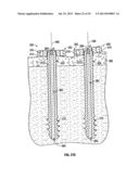 COMPRESSION SCREW SYSTEM diagram and image