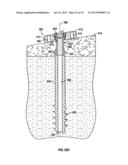 COMPRESSION SCREW SYSTEM diagram and image