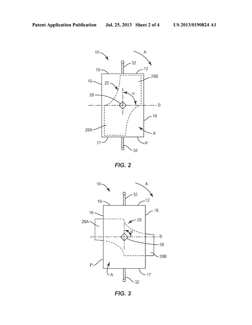 SPINAL CORRECTION SYSTEM AND METHOD - diagram, schematic, and image 03