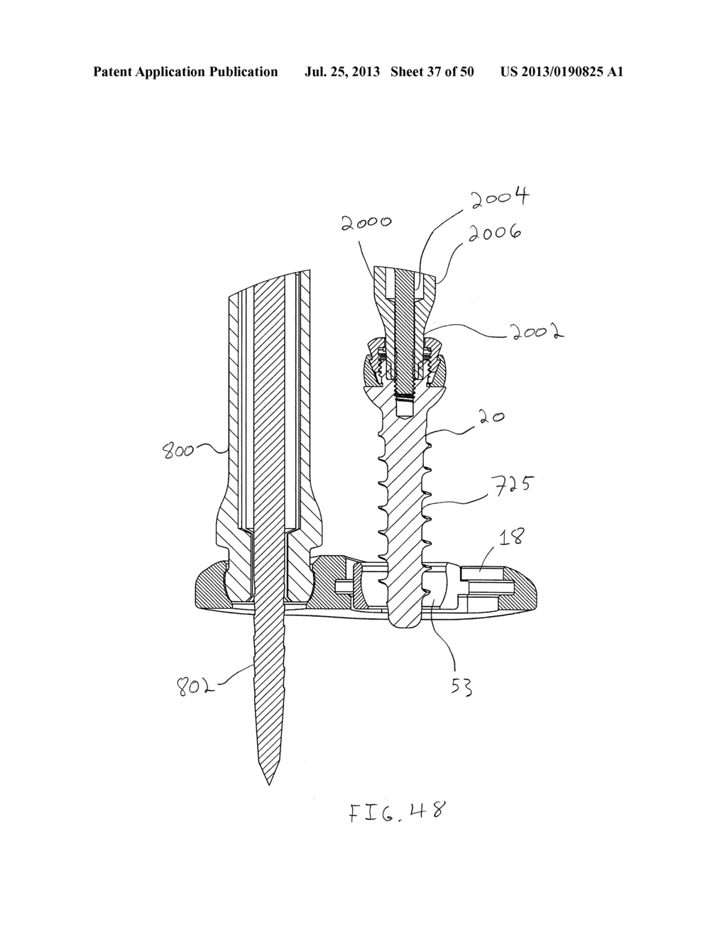 Bone Anchor Assembly, Bone Plate System, And Method - diagram, schematic, and image 38