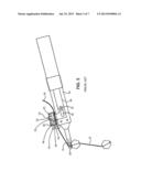 Sternal Reconstruction System diagram and image