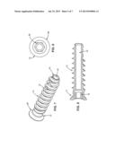 Sternal Reconstruction System diagram and image