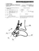 Blade Fixation for Ankle Fusion and Arthroplasty diagram and image