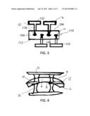 Blade Fixation for Ankle Fusion and Arthroplasty diagram and image