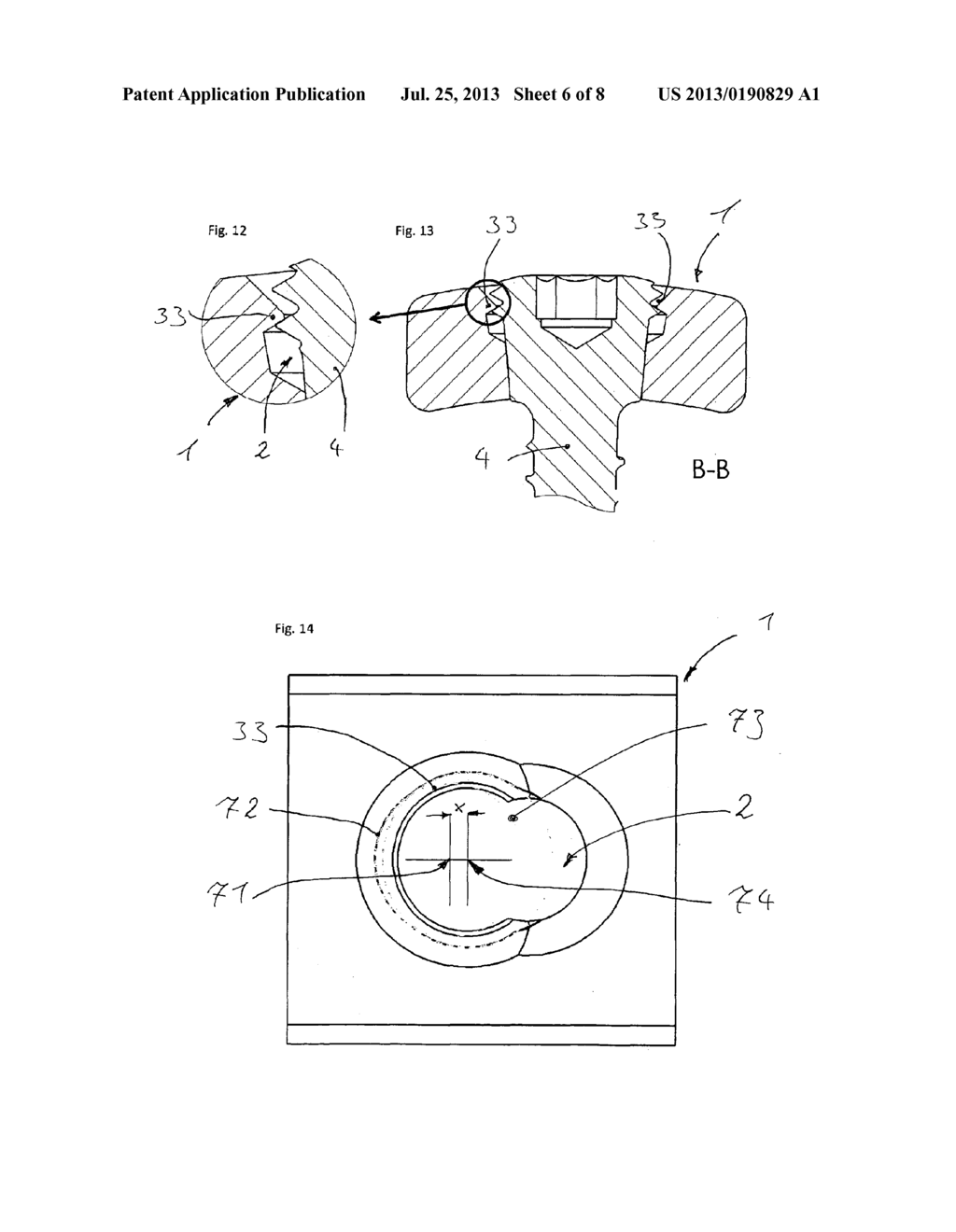 BONE PLATE AND FIXATION SYSTEM COMPRISING A BONE PLATE - diagram, schematic, and image 07