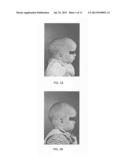 Three Dimensional Life-Size Model of a Child s Skull And Method Using Said     Model diagram and image