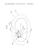 Use of Electric Fields for Reducing Patient Discomfort During     Defibrillation diagram and image