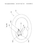 Use of Electric Fields for Reducing Patient Discomfort During     Defibrillation diagram and image