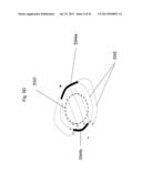 Use of Electric Fields for Reducing Patient Discomfort During     Defibrillation diagram and image