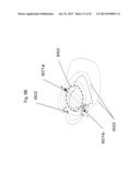 Use of Electric Fields for Reducing Patient Discomfort During     Defibrillation diagram and image