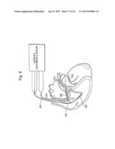 Use of Electric Fields for Reducing Patient Discomfort During     Defibrillation diagram and image