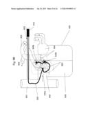 Use of Electric Fields for Reducing Patient Discomfort During     Defibrillation diagram and image