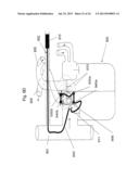 Use of Electric Fields for Reducing Patient Discomfort During     Defibrillation diagram and image