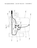 Use of Electric Fields for Reducing Patient Discomfort During     Defibrillation diagram and image