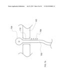 Flexible Light Treatment Head diagram and image