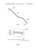 Implantable Devices That Generate Low Intensity Electric Fields For The     Treatment of Atherosclerotic Disease And Prevention of Ischemic Vascular     Events and Methods of Manufacture diagram and image